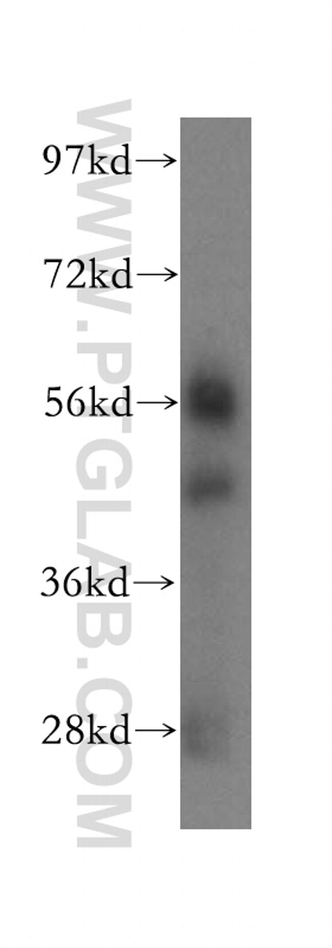 PRCP Antibody in Western Blot (WB)