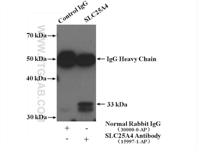 ANT1/2 Antibody in Immunoprecipitation (IP)