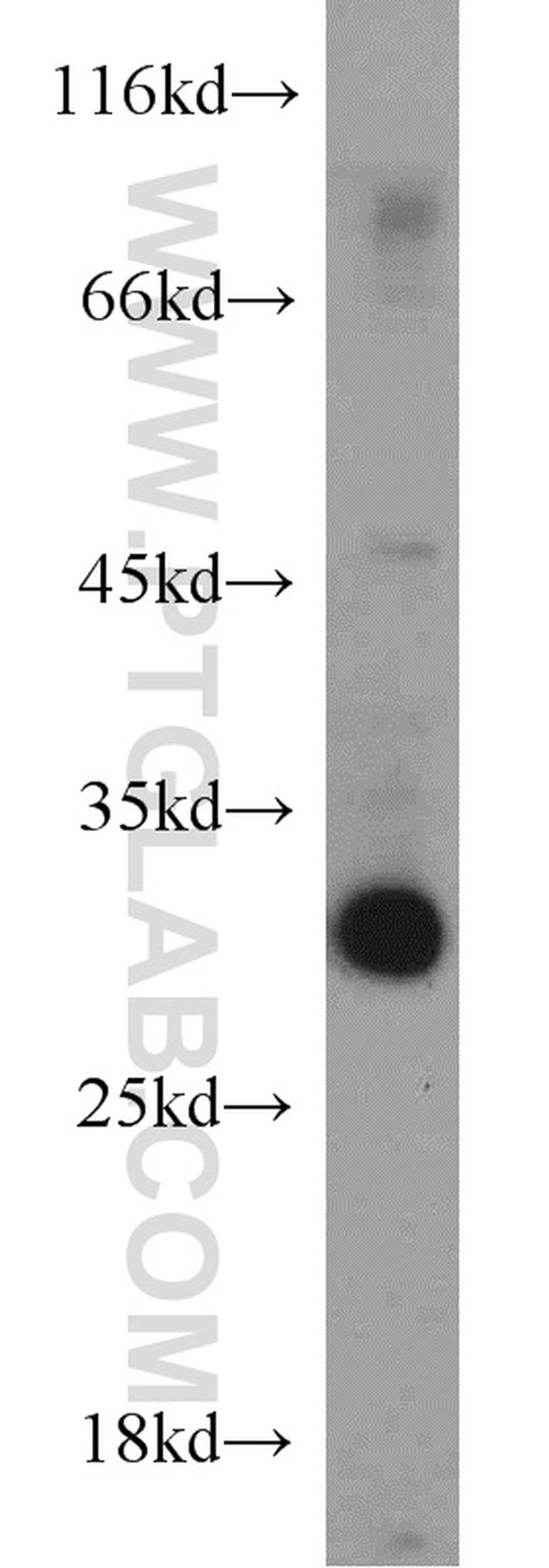 ANT1/2 Antibody in Western Blot (WB)