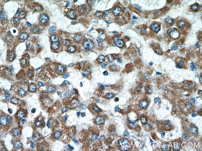 ATP5F1 Antibody in Immunohistochemistry (Paraffin) (IHC (P))