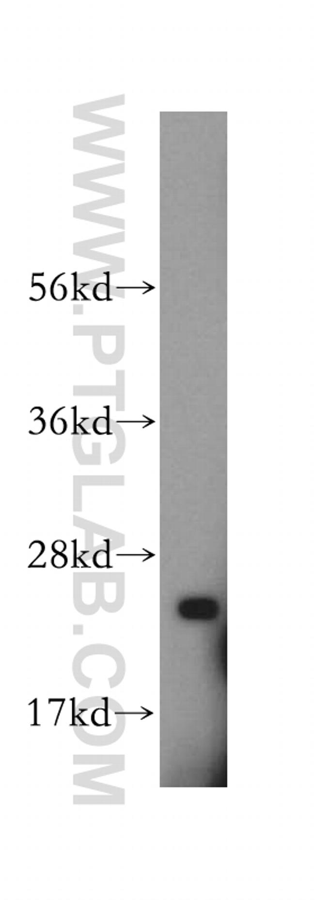 ATP5F1 Antibody in Western Blot (WB)