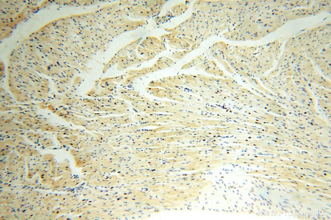 ATP5F1 Antibody in Immunohistochemistry (Paraffin) (IHC (P))