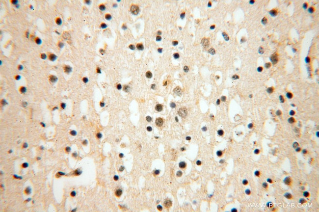 ATP5F1 Antibody in Immunohistochemistry (Paraffin) (IHC (P))