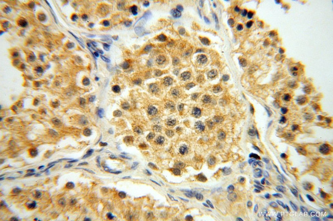 ATP5F1 Antibody in Immunohistochemistry (Paraffin) (IHC (P))