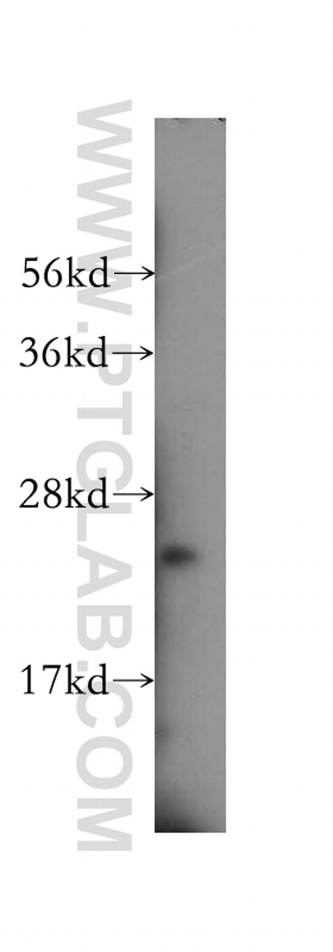 ATP5F1 Antibody in Western Blot (WB)