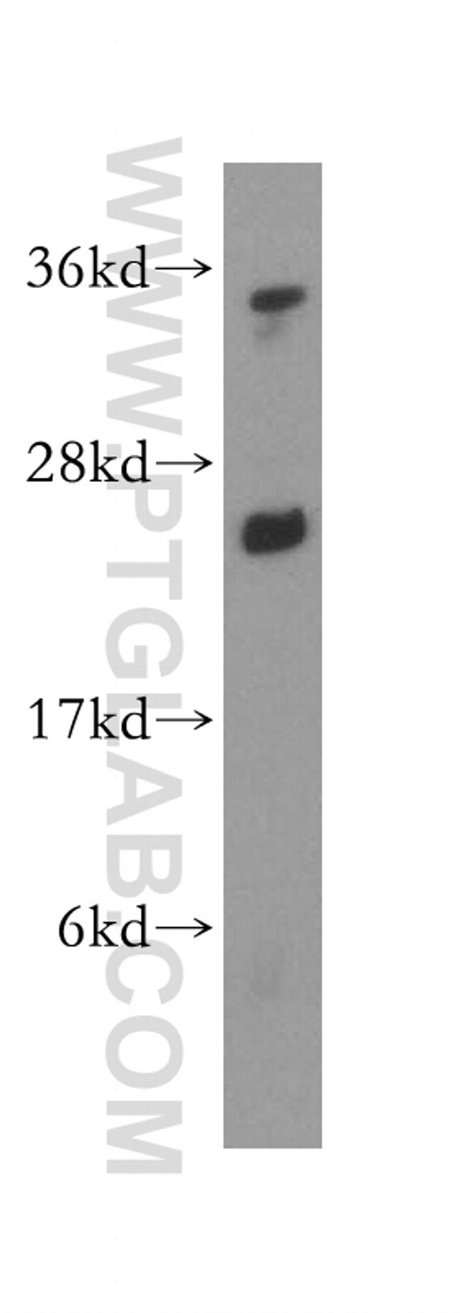 ATP5F1 Antibody in Western Blot (WB)