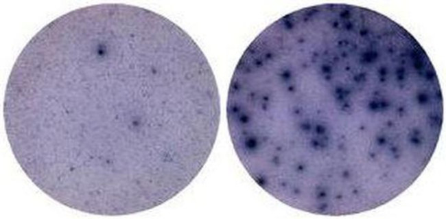 IL-2 Antibody in Immunostaining (IS)