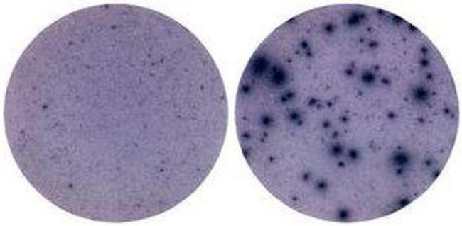 IFN gamma Antibody in Immunostaining (IS)