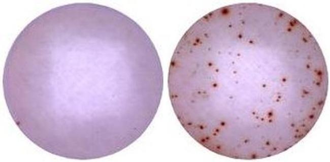 IFN gamma Antibody in Functional Assay (FN)