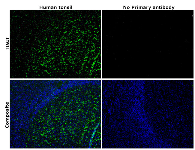 TIGIT Antibody in Immunohistochemistry (Paraffin) (IHC (P))