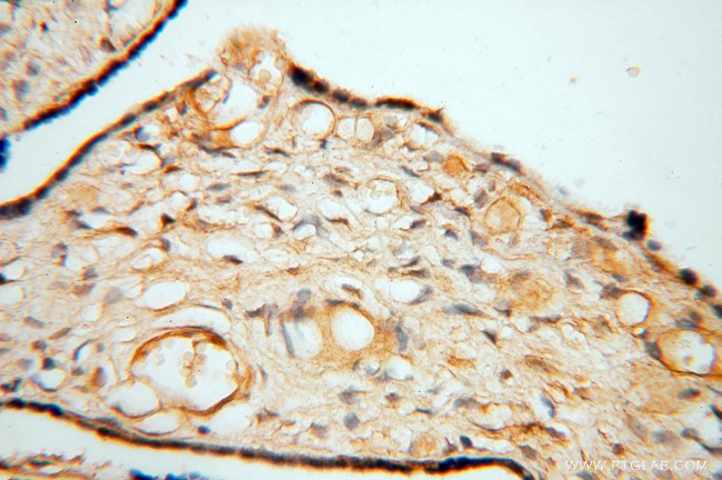 FGL1 Antibody in Immunohistochemistry (Paraffin) (IHC (P))