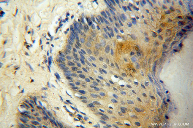 FGL1 Antibody in Immunohistochemistry (Paraffin) (IHC (P))