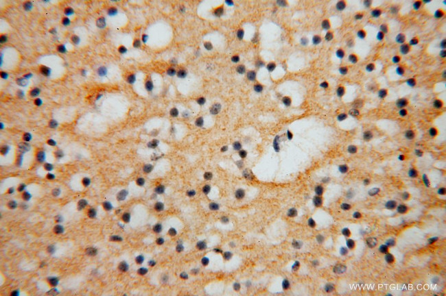 FGL1 Antibody in Immunohistochemistry (Paraffin) (IHC (P))