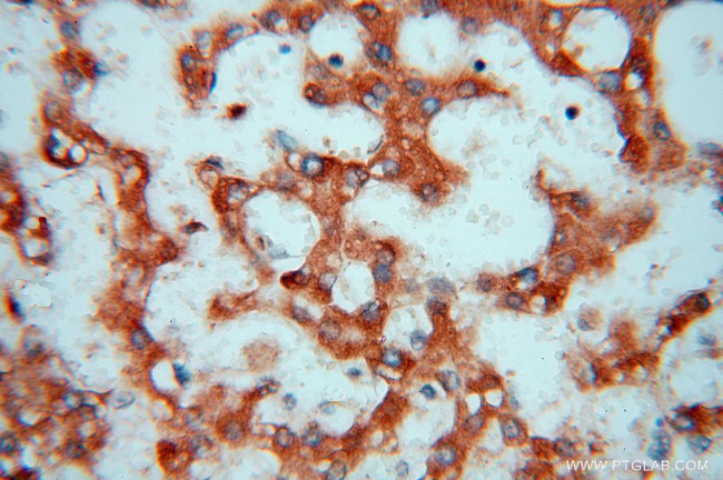 FGL1 Antibody in Immunohistochemistry (Paraffin) (IHC (P))