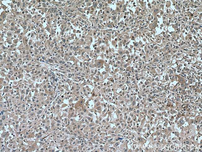 FGL1 Antibody in Immunohistochemistry (Paraffin) (IHC (P))