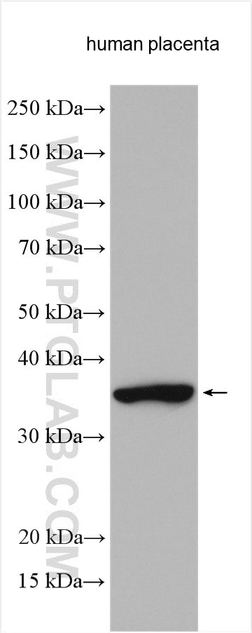 FGL1 Antibody in Western Blot (WB)