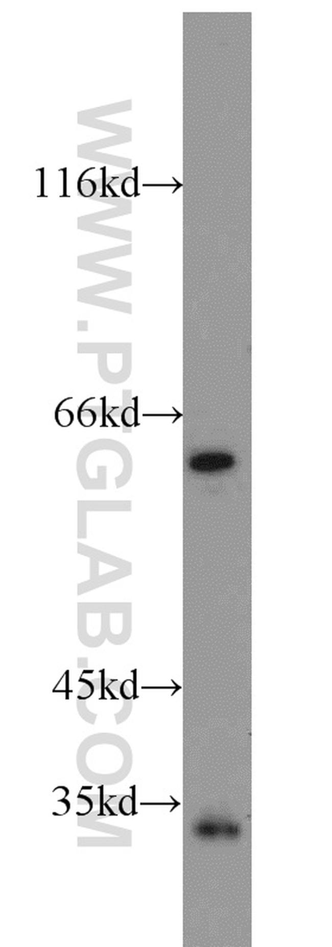 FGL1 Antibody in Western Blot (WB)