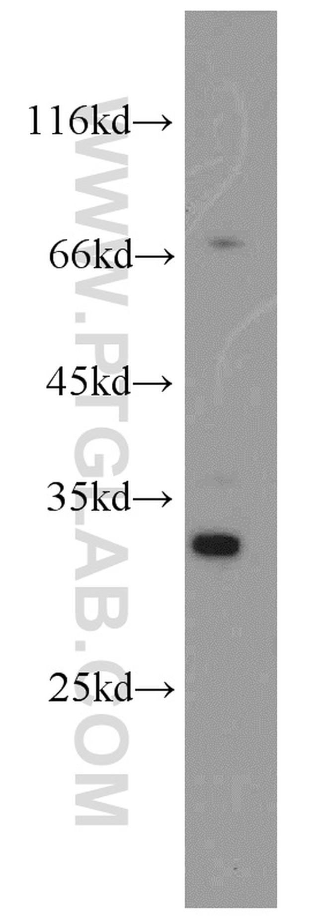 FGL1 Antibody in Western Blot (WB)