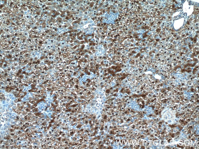 ARG1 Antibody in Immunohistochemistry (Paraffin) (IHC (P))