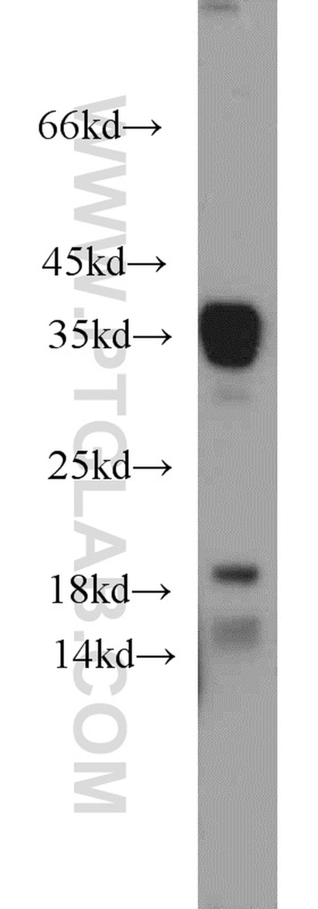 ARG1 Antibody in Western Blot (WB)