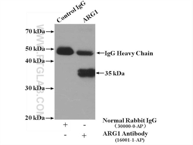 ARG1 Antibody in Immunoprecipitation (IP)