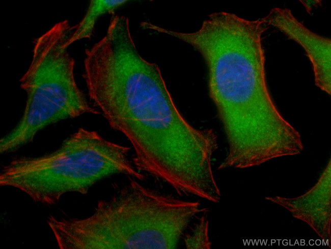 NBR1 Antibody in Immunocytochemistry (ICC/IF)