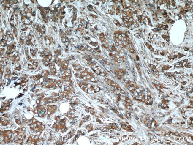 NBR1 Antibody in Immunohistochemistry (Paraffin) (IHC (P))