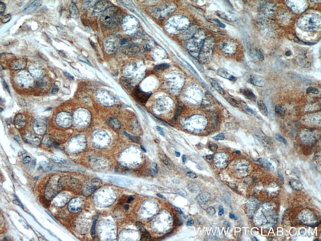 NBR1 Antibody in Immunohistochemistry (Paraffin) (IHC (P))