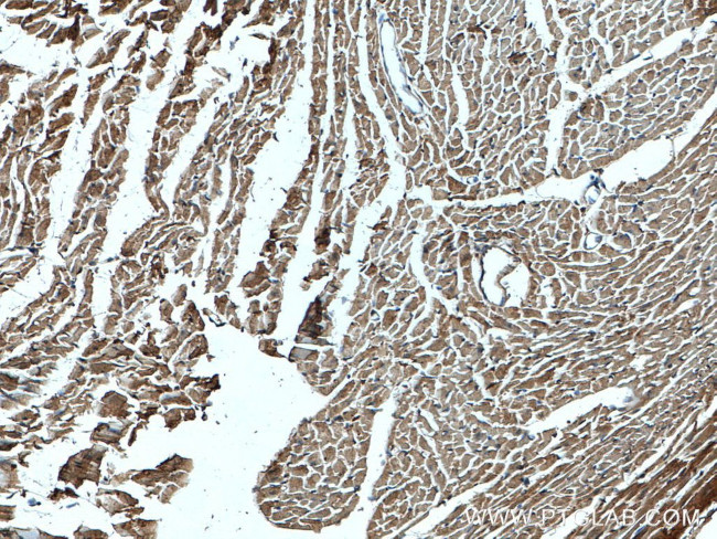 NBR1 Antibody in Immunohistochemistry (Paraffin) (IHC (P))