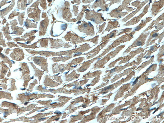 NBR1 Antibody in Immunohistochemistry (Paraffin) (IHC (P))