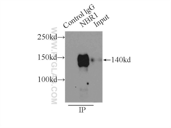 NBR1 Antibody in Immunoprecipitation (IP)