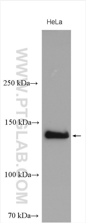 NBR1 Antibody in Western Blot (WB)