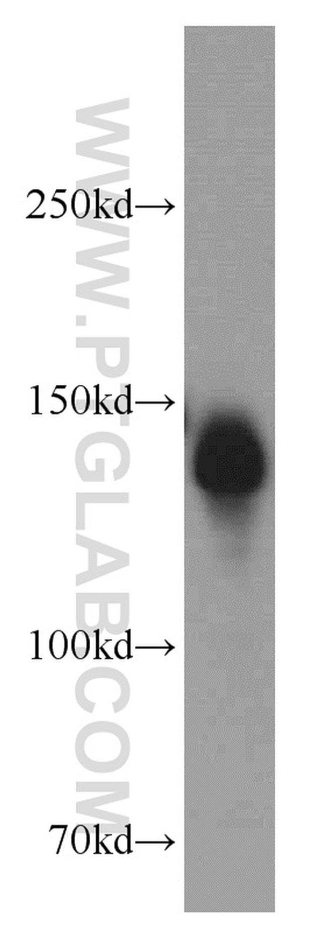 NBR1 Antibody in Western Blot (WB)