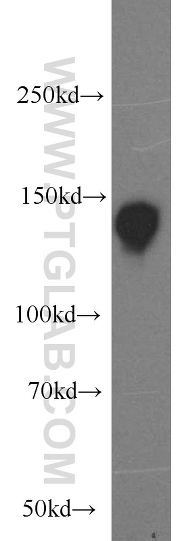 NBR1 Antibody in Western Blot (WB)