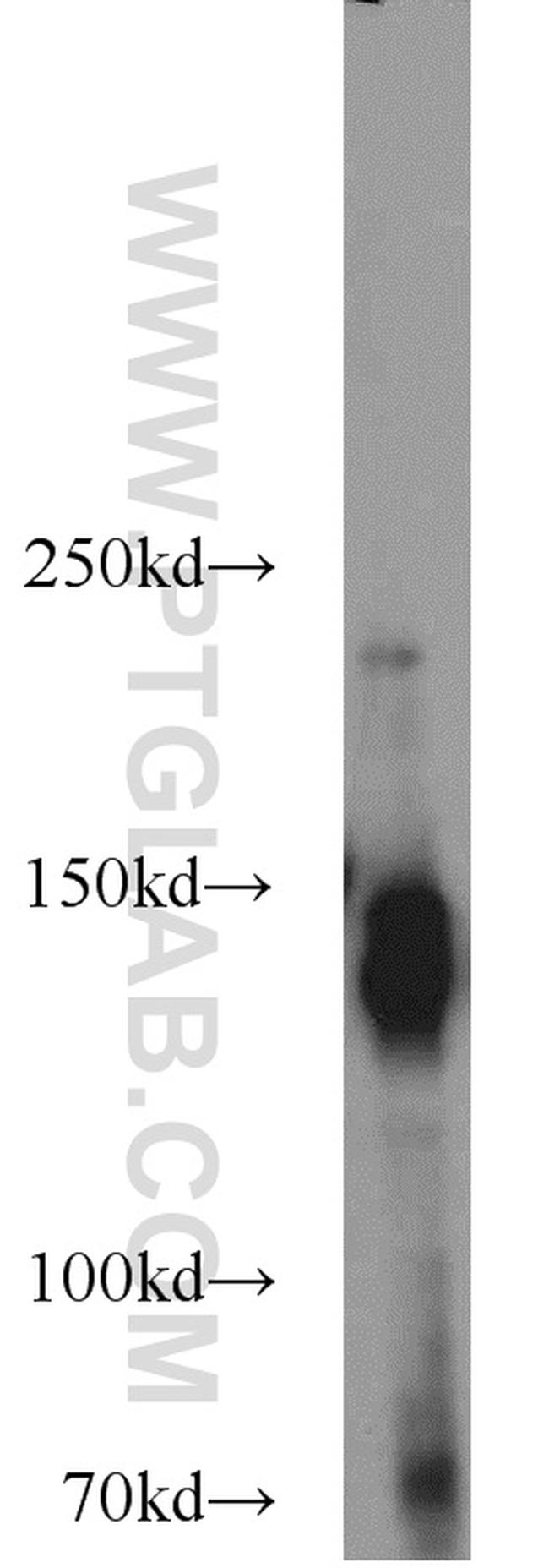 NBR1 Antibody in Western Blot (WB)