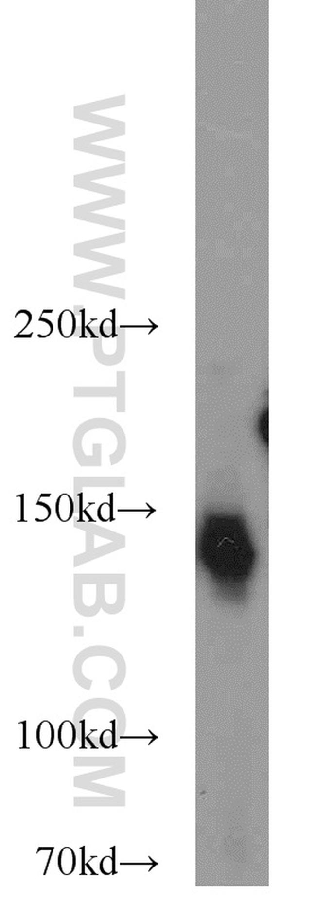 NBR1 Antibody in Western Blot (WB)