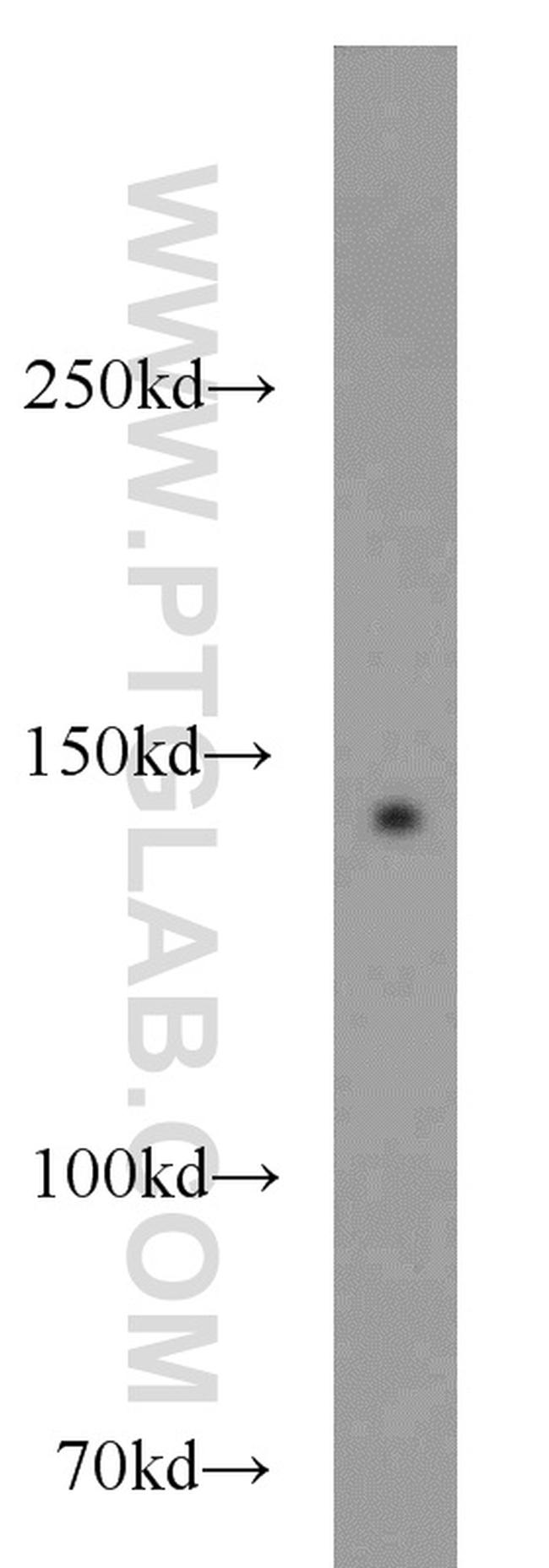 NBR1 Antibody in Western Blot (WB)