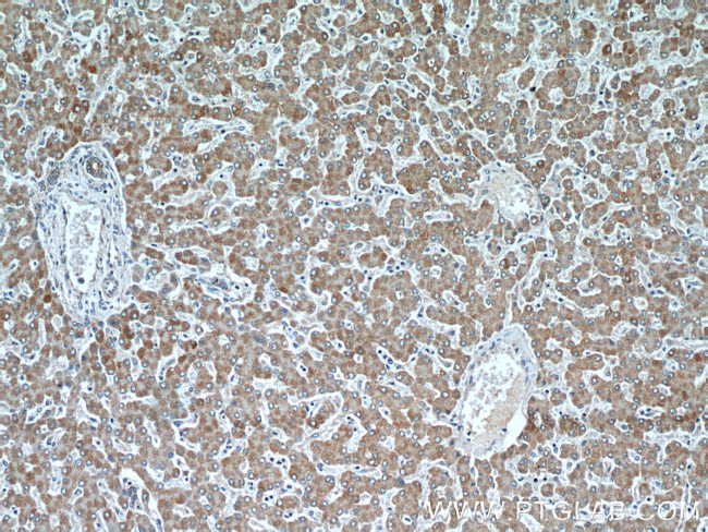 CISD1 Antibody in Immunohistochemistry (Paraffin) (IHC (P))