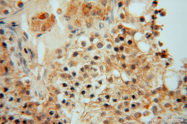 CISD1 Antibody in Immunohistochemistry (Paraffin) (IHC (P))