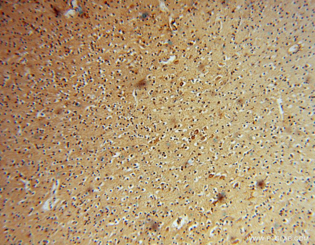 CISD1 Antibody in Immunohistochemistry (Paraffin) (IHC (P))