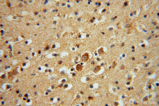 CISD1 Antibody in Immunohistochemistry (Paraffin) (IHC (P))