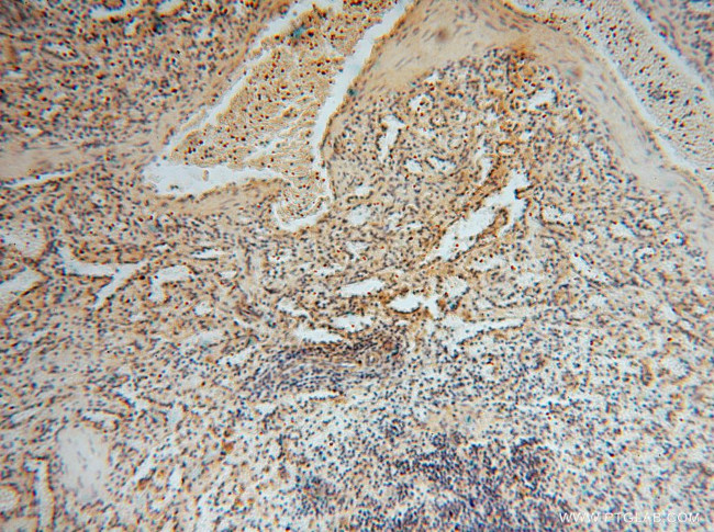 CISD1 Antibody in Immunohistochemistry (Paraffin) (IHC (P))