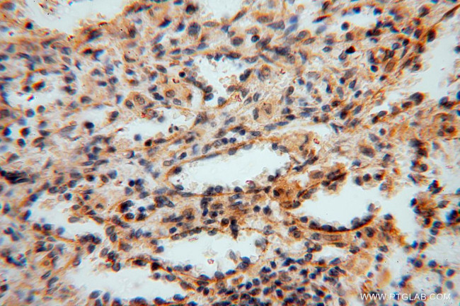 CISD1 Antibody in Immunohistochemistry (Paraffin) (IHC (P))