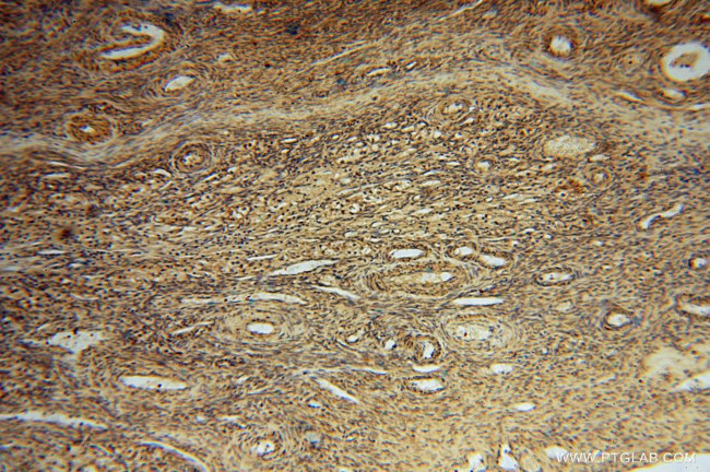 CISD1 Antibody in Immunohistochemistry (Paraffin) (IHC (P))