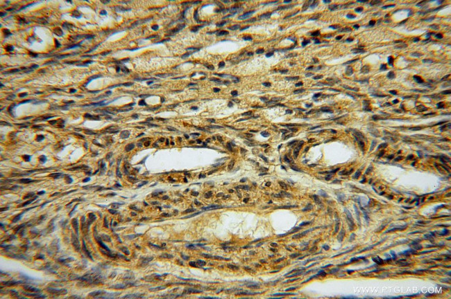 CISD1 Antibody in Immunohistochemistry (Paraffin) (IHC (P))