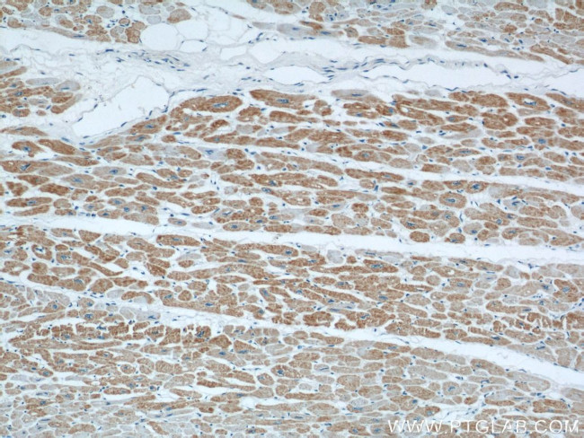 CISD1 Antibody in Immunohistochemistry (Paraffin) (IHC (P))