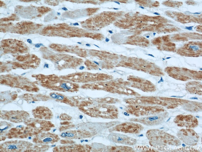 CISD1 Antibody in Immunohistochemistry (Paraffin) (IHC (P))