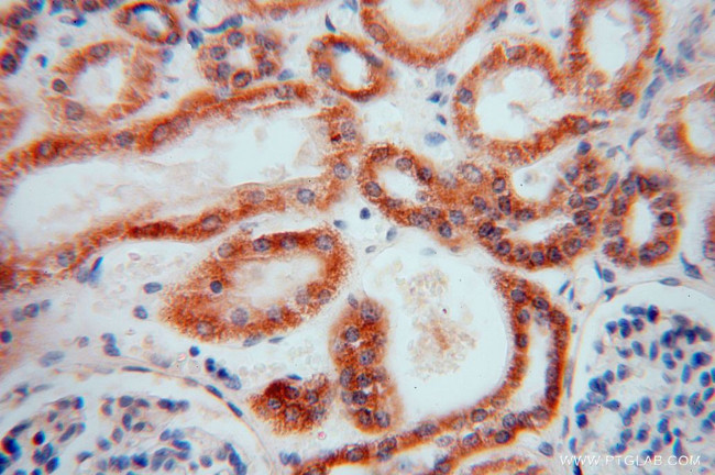 CISD1 Antibody in Immunohistochemistry (Paraffin) (IHC (P))