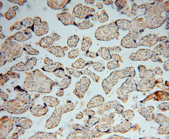 CISD1 Antibody in Immunohistochemistry (Paraffin) (IHC (P))