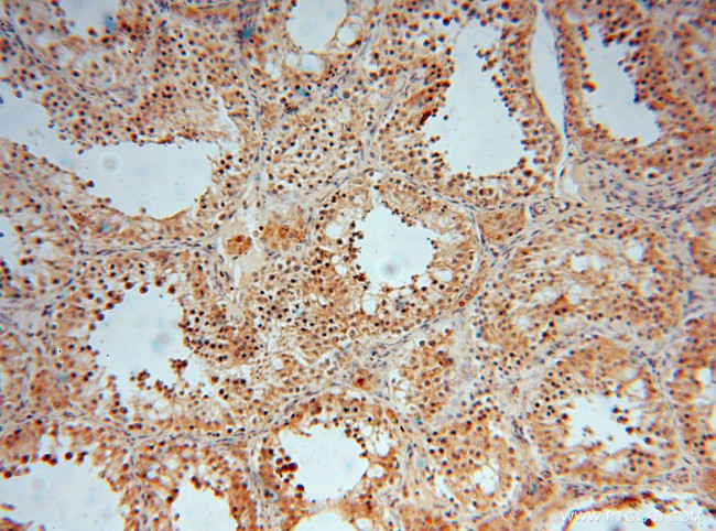 CISD1 Antibody in Immunohistochemistry (Paraffin) (IHC (P))